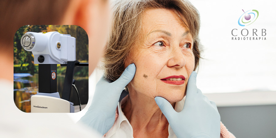 Quando e como a radioterapia para câncer de pele é indicada no tratamento